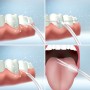 Irrigateur Buccal Rechargeable Portable Denter InnovaGoods: Plus de 300.000 produits de grandes marques en vente directe à prix 