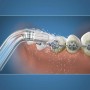 Tête de rechange Waterpik OD-100E: Plus de 300.000 produits de grandes marques en vente directe à prix usine sur cadeaufou.com. 