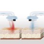 Masseur Anti-cellulite à Cavitation par Ultrasons avec Infrarouge et Électrostimulation 3 en 1 CellyMax InnovaGoods: Plus de 300